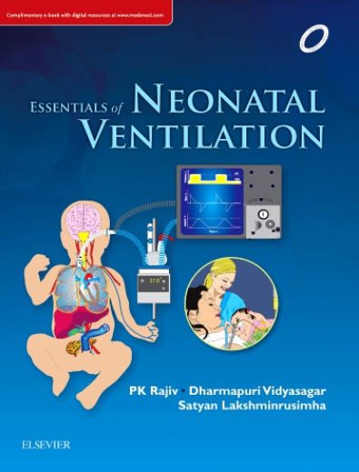 Essentials of Neonatal Ventilation, 1st edition